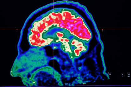 Microplastics are everywhere, but data is still lacking about how they could be affecting our brains - Fred TANNEAU (AFP)