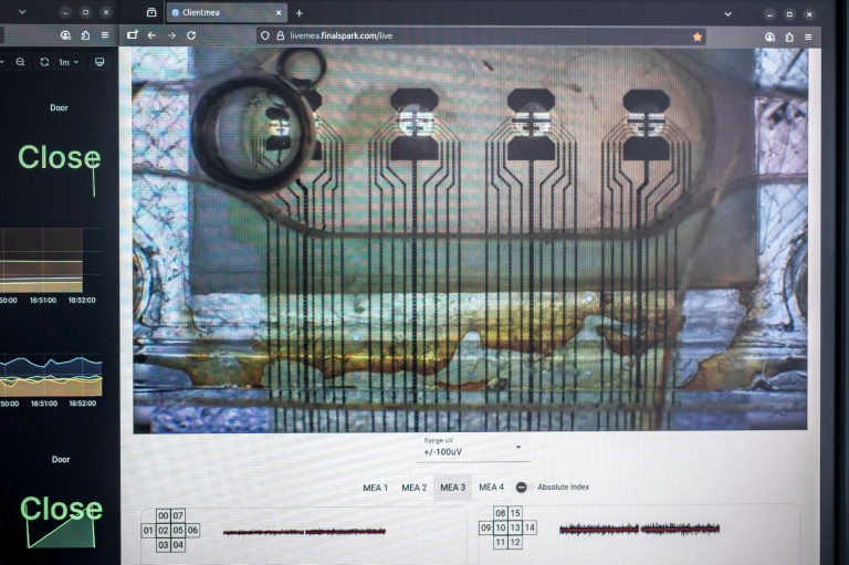 'Wetware': Scientists use human mini-brains to power computers